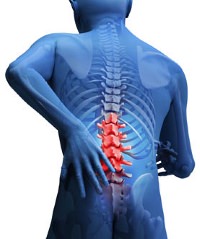 Backache Pain